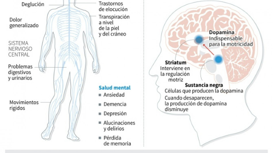 Jap&oacute;n aprueba el primer tratamiento mundial con c&eacute;lulas madre para el p&aacute;rkinson