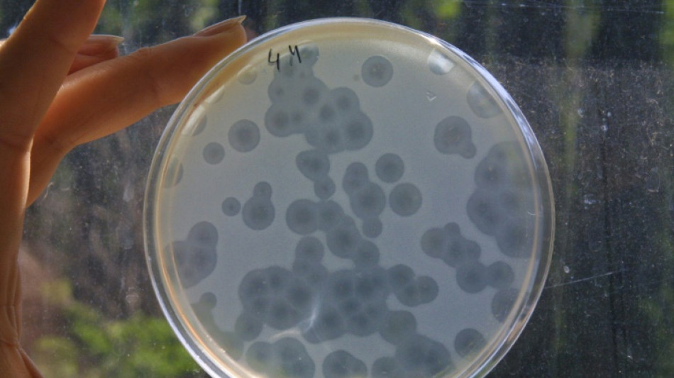 Les infections bact&eacute;riennes, deuxi&egrave;me cause de d&eacute;c&egrave;s dans le monde