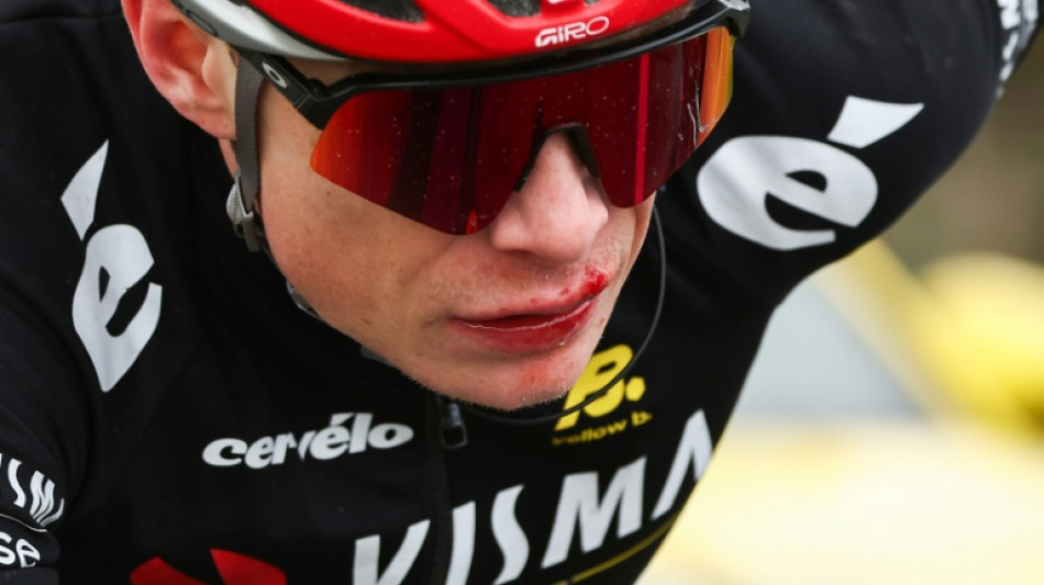 Paris-Nice: Vingegaard chute et repart avec la lèvre en sang